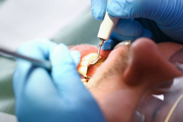 Best Mobile Emergency Dentist in Marietta, PA